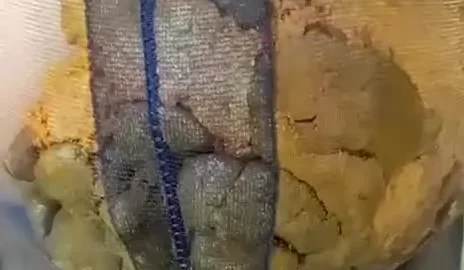 Chinese Girl Pooping – Soiled Underwear Bathroom Scene