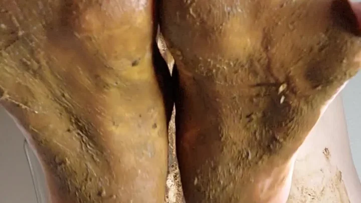 Mycelium Mother – Dirtytalking Toes