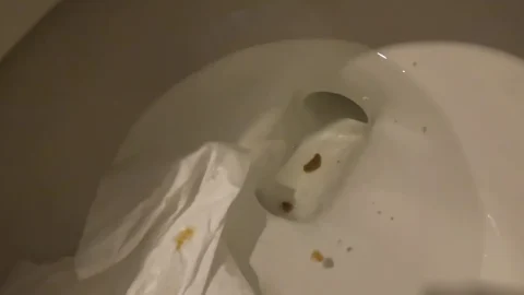 Gassy – Coffee Aftermath Plus Shart Compilation